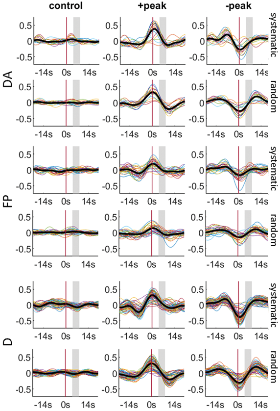The interaction between random and systematic visual stimulation and
infraslow quasi-periodic spatiotemporal patterns of whole-brain
activity